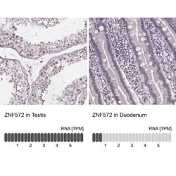 ZNF572 Antibody, Novus Biologicals 25 &mu;L, Unlabeled:Antibodies, Polyclonal